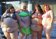 Will 250,000 Morbidly Obese People Sign Allergan’s Petition to Congress?